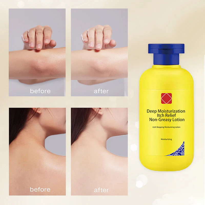 🔥Winter promotion 49% OFF🔥Deep moisturizing itch relief Non-greasy lotion❄️ ☃️ - Image 5